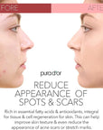 sniperdeal-best-pura-d'or-organic-rosehip-seed-oil-for-gulf