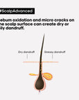 l'oeal-scalp-advanced-2-in-1-deep-purifier-clay-mask-closeup-sniperdeal-exclusive
